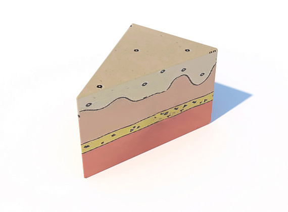 Ограждение «Кусок торта»